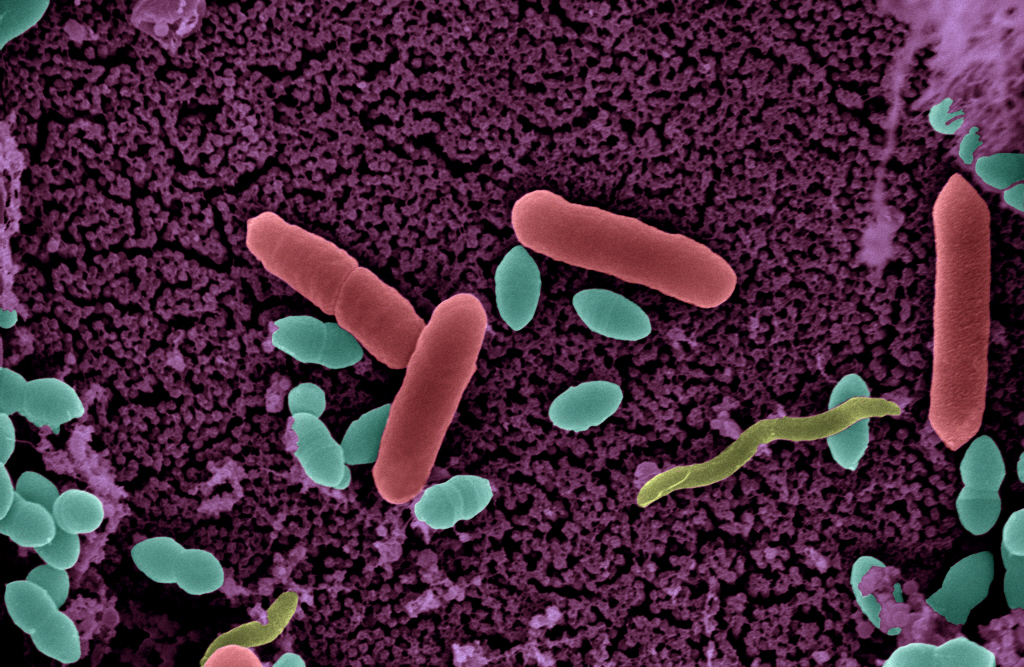 Copyright : Institut Pasteur/Perrine Bomme et Nouara Lhocine- Colorisation Jean-Marc Panaud